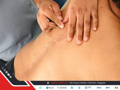 acupuncture therapy workshop csbm campus