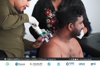 cupping therapy workshop csbm campus