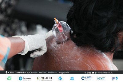 cupping therapy workshop csbm campus