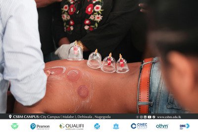 cupping therapy workshop csbm campus