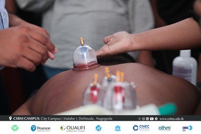 cupping therapy workshop csbm campus