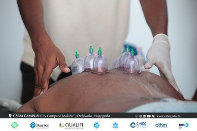 cupping therapy workshop csbm campus