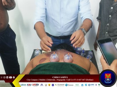 cupping therapy workshop csbm campus