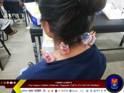 cupping therapy workshop csbm campus